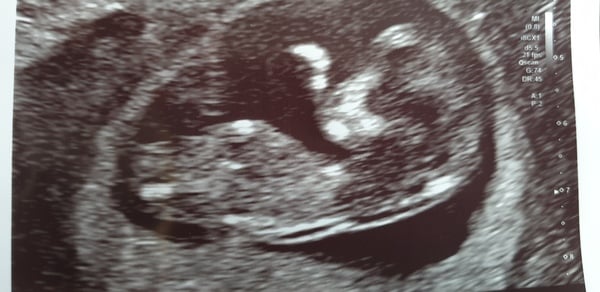 The Graduates of TTC after pregnancy loss thread #2 "The Penguin Huddle " 🐧🐧🐧