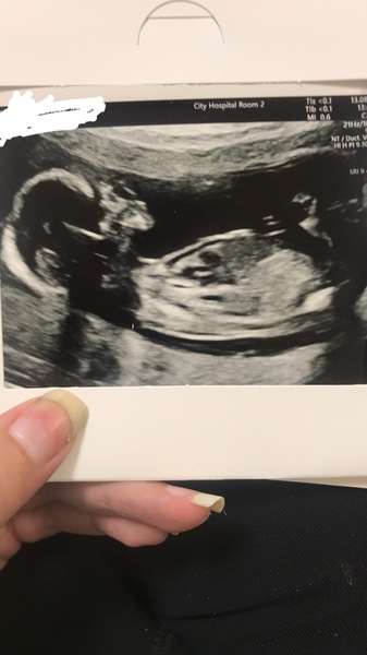 Guess the sex! 💕💙