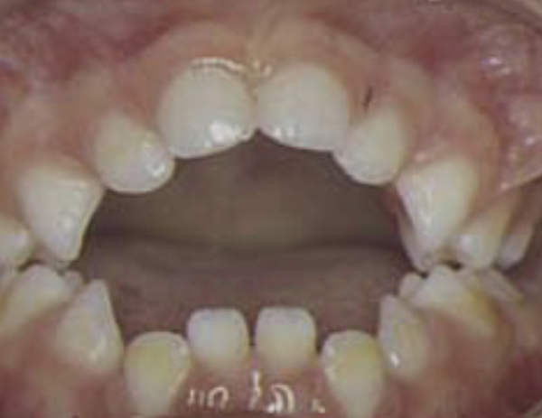 6 yr old DD still has a dummy