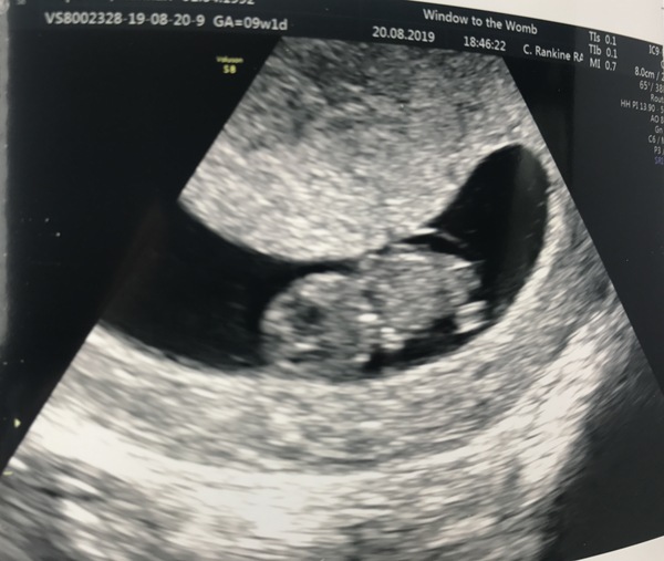 March Babies #3
