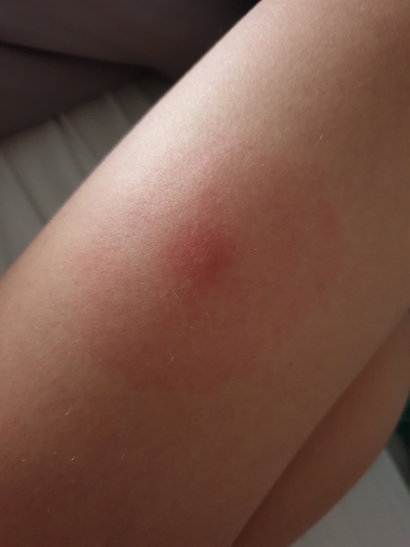 Do I need to take ds to drs with this?