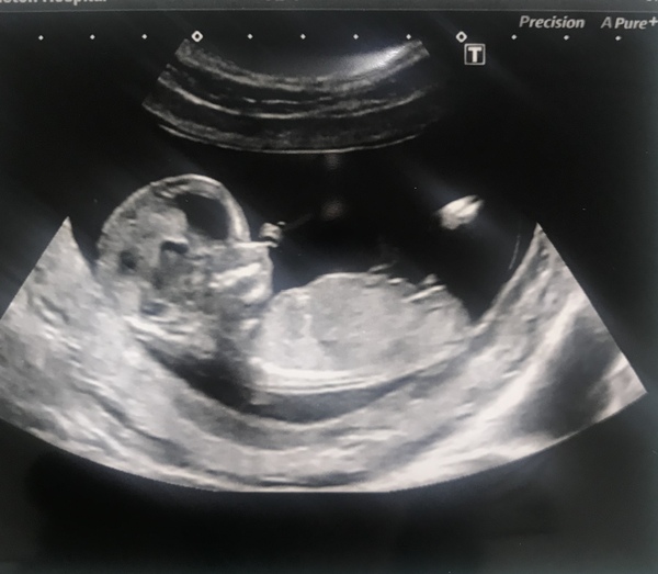 March Babies #3