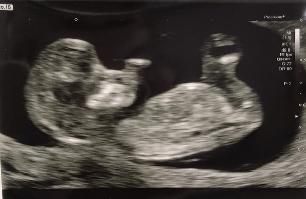 March Babies #3
