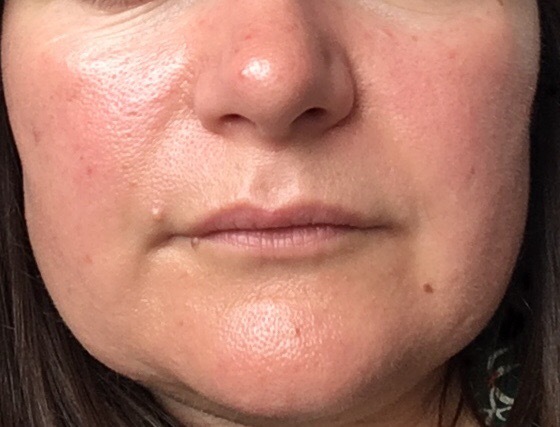 Critique my skin