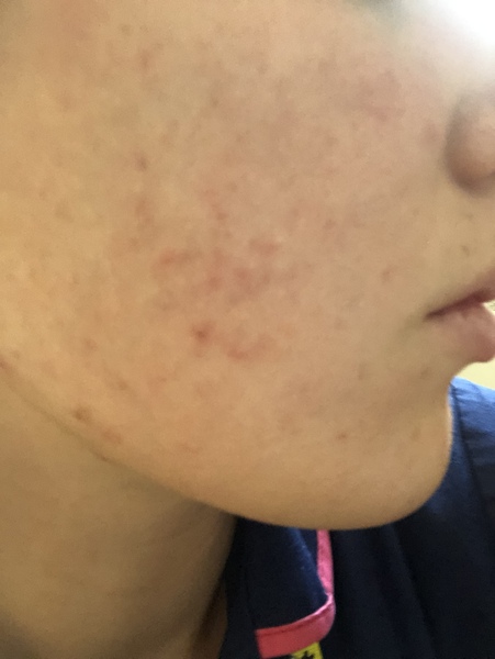 Skincare - Absolutely clueless