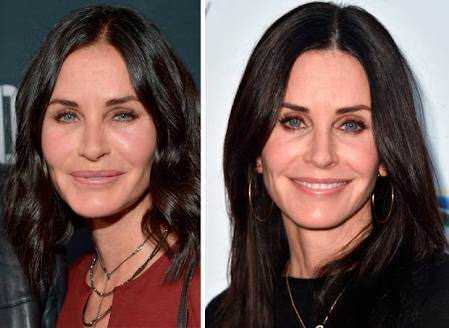 To think some of the celebrities WANT the weird look they have