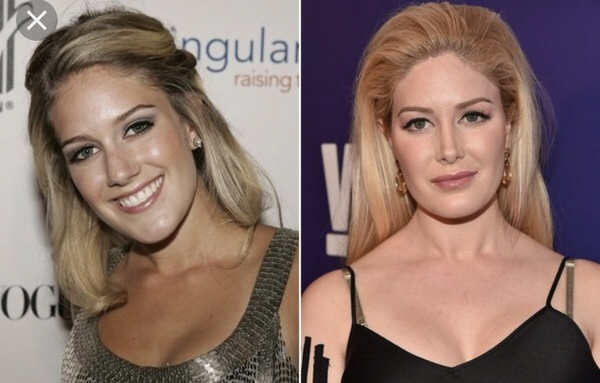 To think some of the celebrities WANT the weird look they have