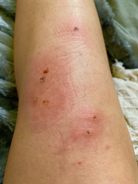 Does this look infected? (With photos)