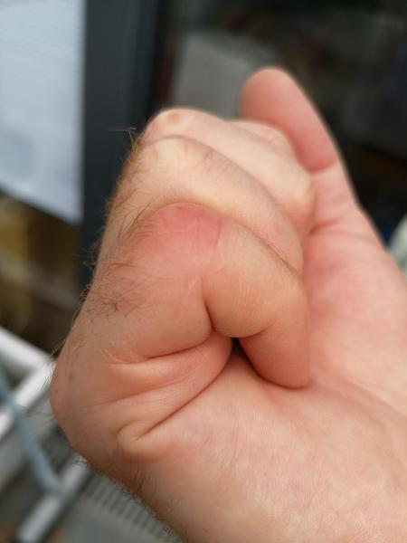 Something has bitten DH - what could it be? [Pic]