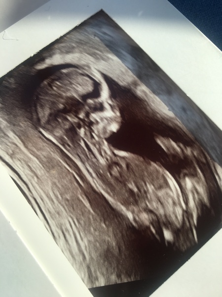 Nub/Skull theory - any ideas?