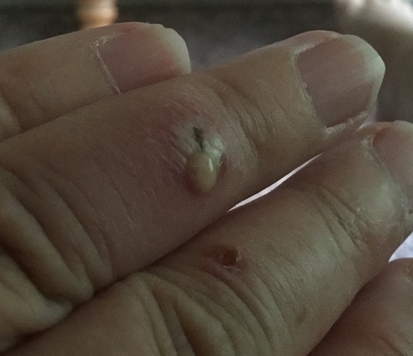 Bloody cat infected hand