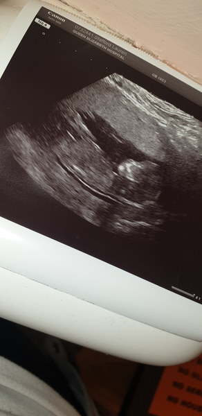 Girl or boy?