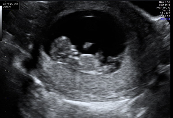 March Babies #2