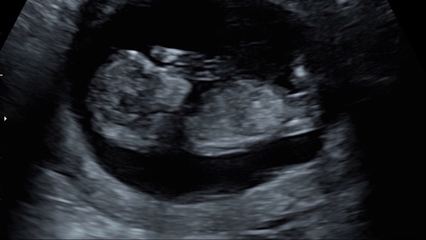 March Babies #3