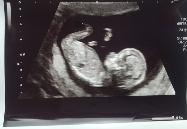 First ever post- Guess the sex 💙💗
