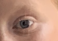 Dd’s lack of eyebrows
