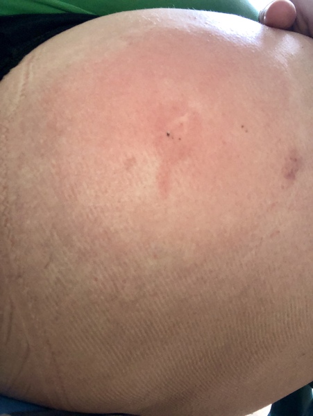 What should I do about this