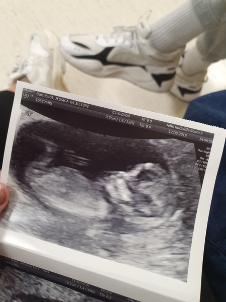Gender guess!