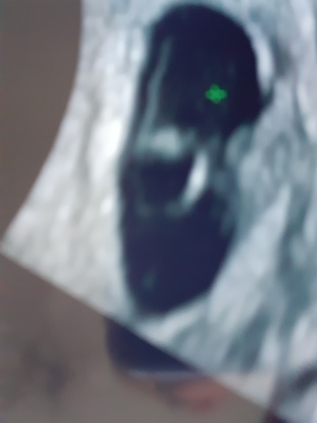 help please - i think i may be miscarrying