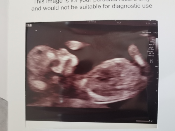 March Babies #3