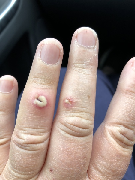 Bloody cat infected hand