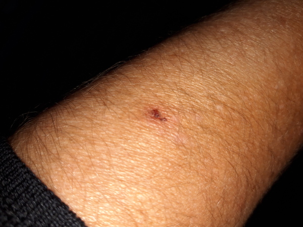 Any dermatologists around?