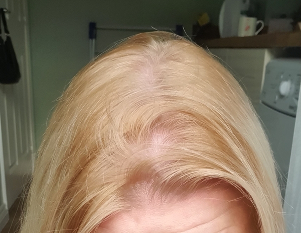 Hair Dye failure- please help