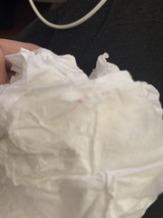 Could this be implantation bleed