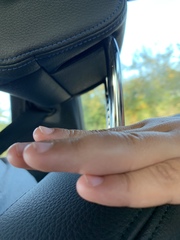 Should I go to the GP about ds’s finger?