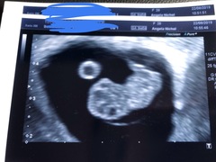 March Babies #3