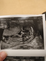 BFP - Anyone else feb 2020? Continued ...