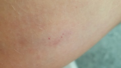 To ask for your opinion on weird symptoms?