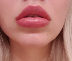 Sooo, who’s tried lip fillers?!
