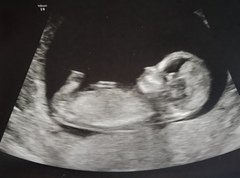 Boy or Girl? 13 week scan...