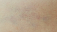To ask for your opinion on weird symptoms?