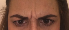 For getting Botox in my 20’s?