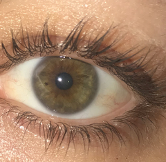 Eye colour