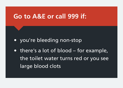 TMI but any doctors about? Bleeding... help!