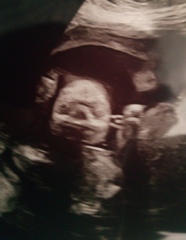 January 2020 - thread six