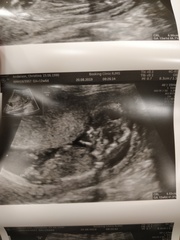 BFP - Anyone else feb 2020? Continued ...