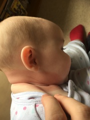What is this rash on my baby?!