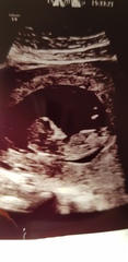 Can you guess a gender?