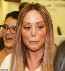 For getting Botox in my 20’s?