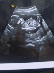 BFP - Anyone else feb 2020? Continued ...