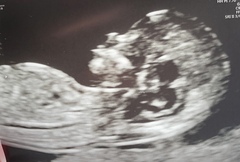 Can you help me guess the gender?