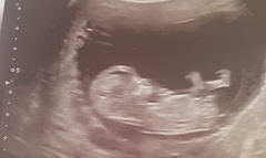 Due March 2020 - FIRST BABY in late 20's