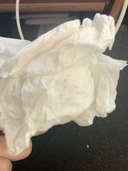 TWW symptoms, CM, spotting?
