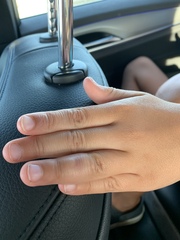 Should I go to the GP about ds’s finger?