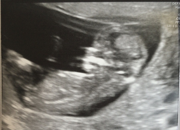 March Babies #3