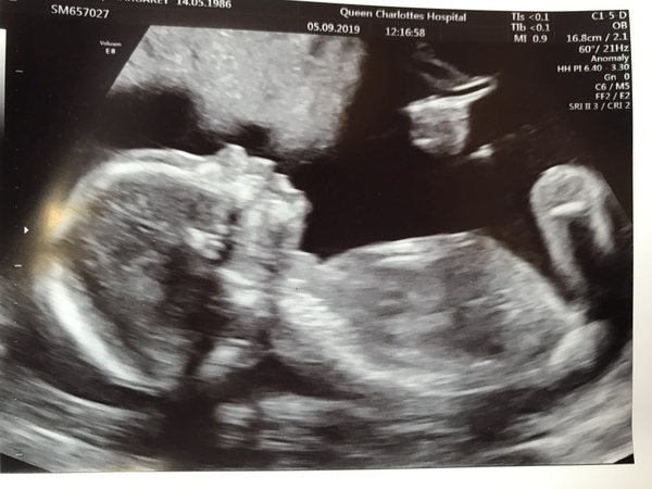 Graduates of the TTC After Pregnancy Loss thread. Aka: The Penguin Huddle